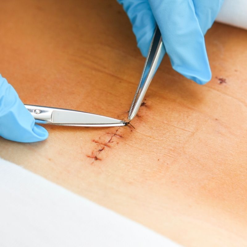 servicio de enfermeria en bogota