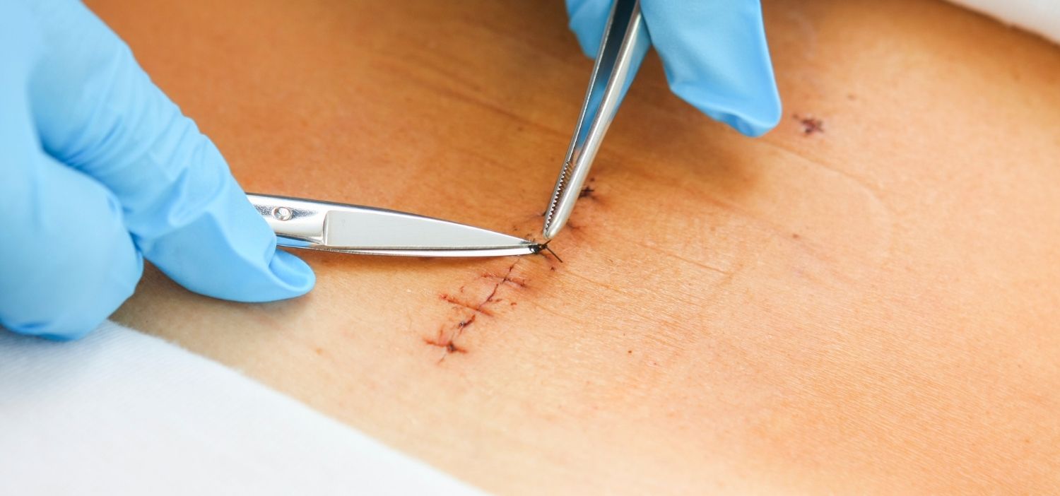 servicio de retiro de puntos